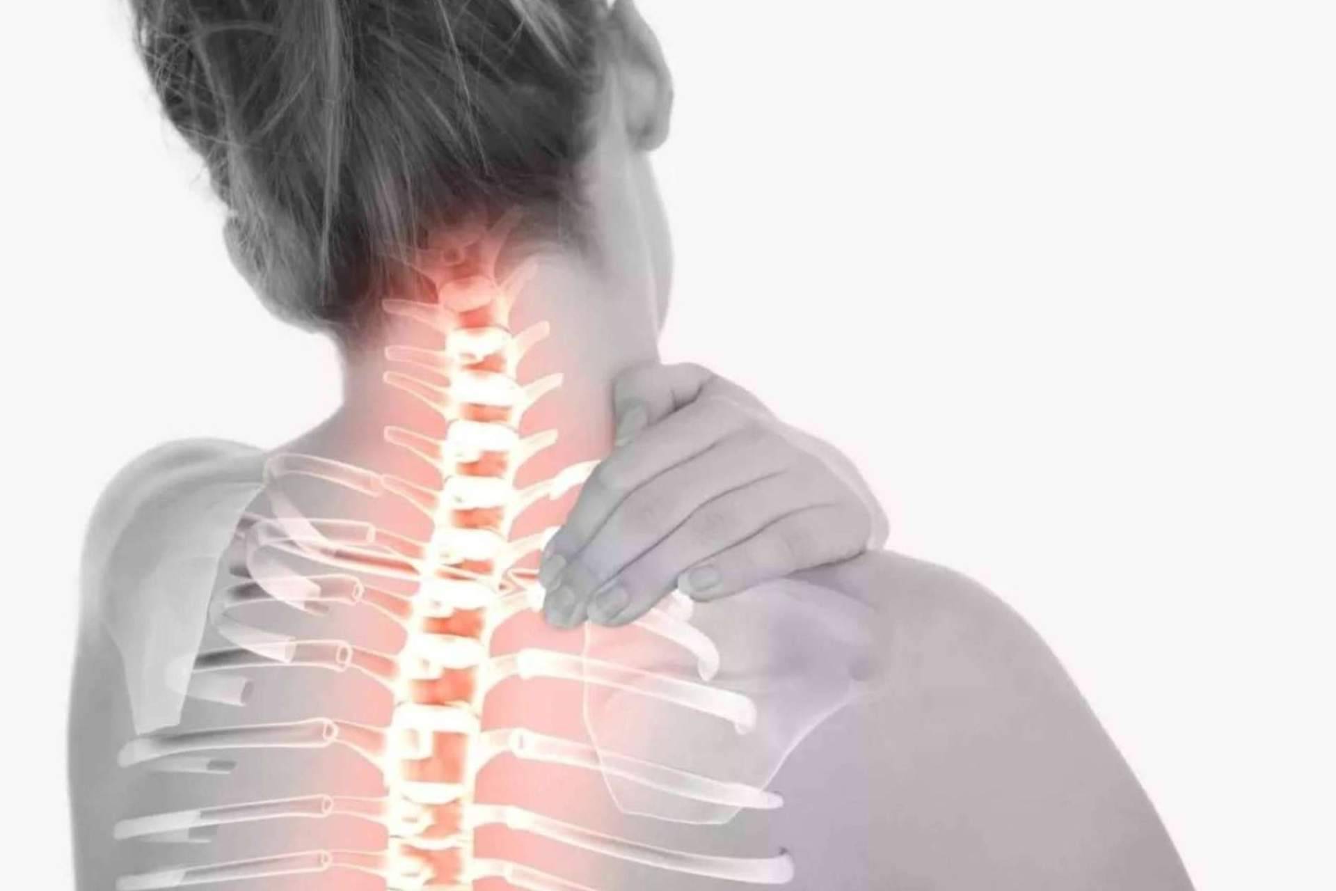 Tratar el dolor cervical provocado por hernias discales, con CNQ