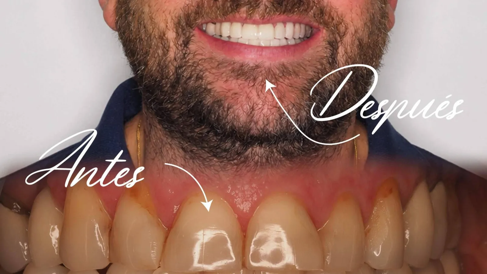 Clínica Calvo de Mora ofrece implantología y cirugía maxilofacial con tecnología de última generación